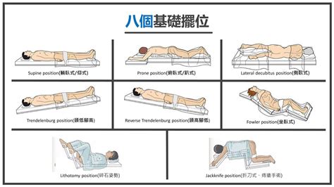 截刀式臥位 老坟头